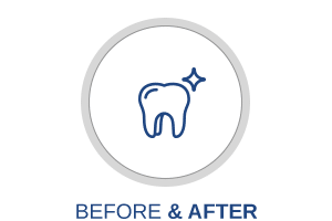 Before and After Musgrave Orthodontics in Waldo and Delaware, OH