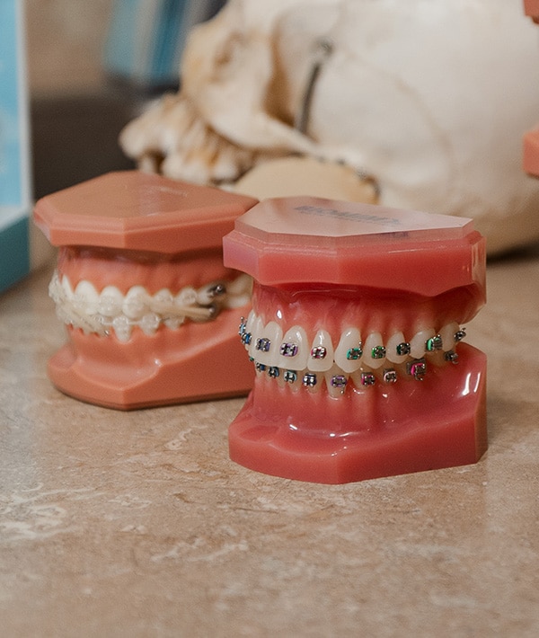 Types of Braces Musgrave Orthodontics in Delaware and Waldo, OH